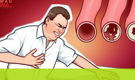 20 Foods That Will Clean Your Arteries Naturally And Protect You From Heart Attacks
