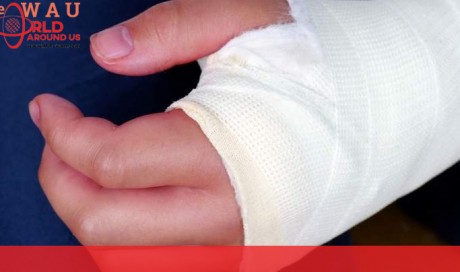 Man starves wife for 4 days in UAE, breaks her fingers after she begs for food
