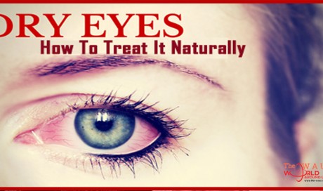How to Get Rid of Dry Eyes Naturally