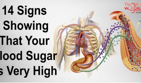14 symptoms of high blood sugar and which foods reduce it
