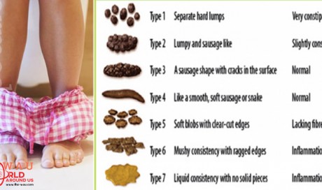 Believe it or not, Your Poop Can tell if you are Healthy or not!