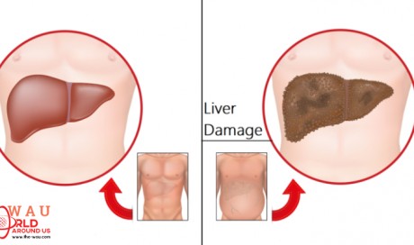 7 Early Warnings of Liver Damage to Never Ignore