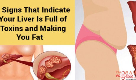 6 Signs That Indicate Your Liver Is Full of Toxins and Making You Fat