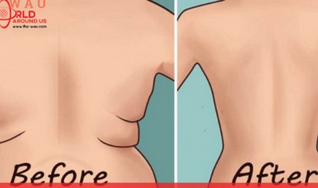 Try the World's 5 Easiest Exercises for Back Fat and Underarm Flab
