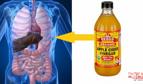 They Said Apple Cider Vinegar Is Great For You, BUT This Is What They Didn’t Tell You