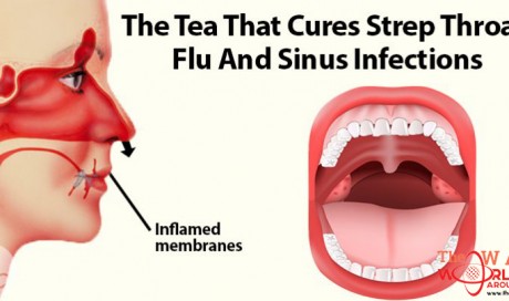 The Tea That Can Help Treat Strep Throat, Fu And Sinus Infections
