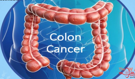 9 Tips for Colon Cancer Survivals!