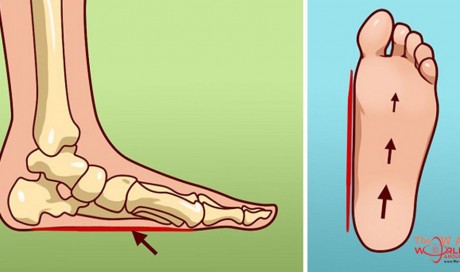 Why your Feet Hurt All the Time and How to Fix it