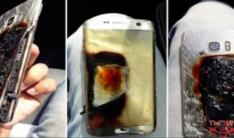 Man burns leg after phone catches fire