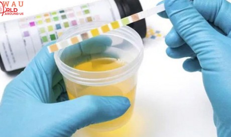 What Does The Color Of Your Urine Say About Your Wellness
