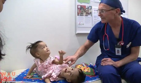15-month-old Bhutanese twins joined at torso separated after 6 hr surgery in Australia