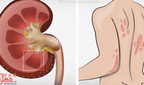 The Body Will Give You These 10 Signs If Your Kidney Is In Danger