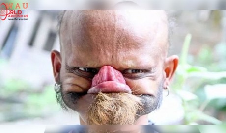 Nepali Man Shows Off Bizarre Ability To Lick His Own Forehead