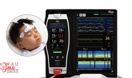 Masimo Announces CE Marking of Pediatric Indication for Next Generation SedLine® Brain Function Monitoring