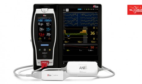 Masimo Announces First CE-marked Third-party Masimo Open Connect® Module for the Root® Patient Monitoring and Connectivity Hub