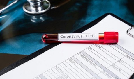 Coronavirus Update: Pizza Delivery Agent Tests Positive In Delhi, 72 Families Quarantined