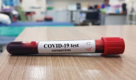 55 new coronavirus cases reported in Oman